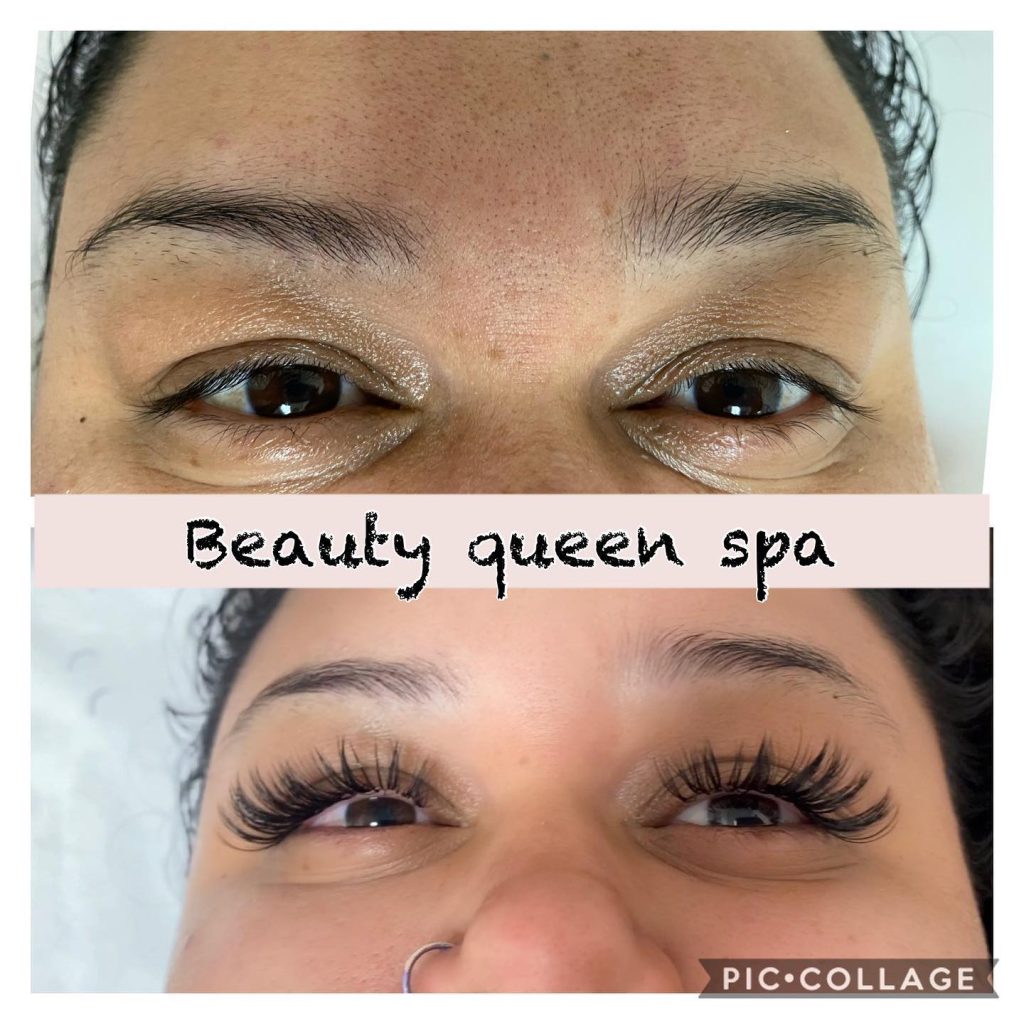 permanent makeup removal